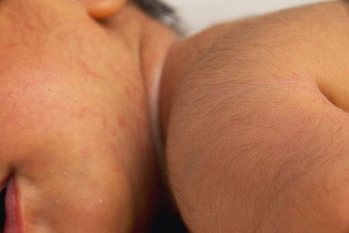 Todo lo que necesitas saber del lanugo en el bebé: definición, funciones y curiosidades médicas - Mustela Mexico - 1