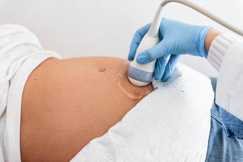 9 Preguntas Clave para Hacerle a tu Doctor Durante el Embarazo - Mustela Mexico - 1