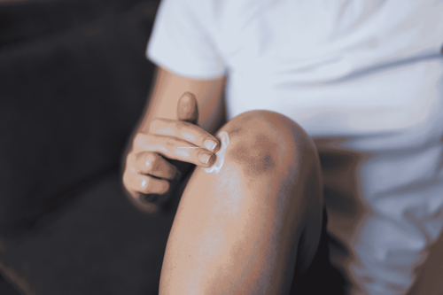 Beneficios_del_arnica - Mustela Mexico - 1