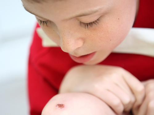 Mustela_Website_25 - Mustela Mexico - 1