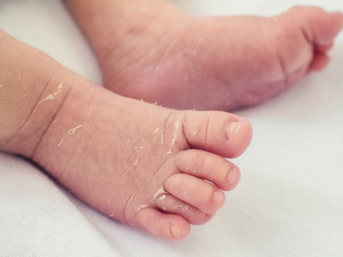 Mustela_Website_37 - Mustela Mexico - 1