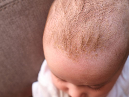 Mustela_Website_41 - Mustela Mexico - 1