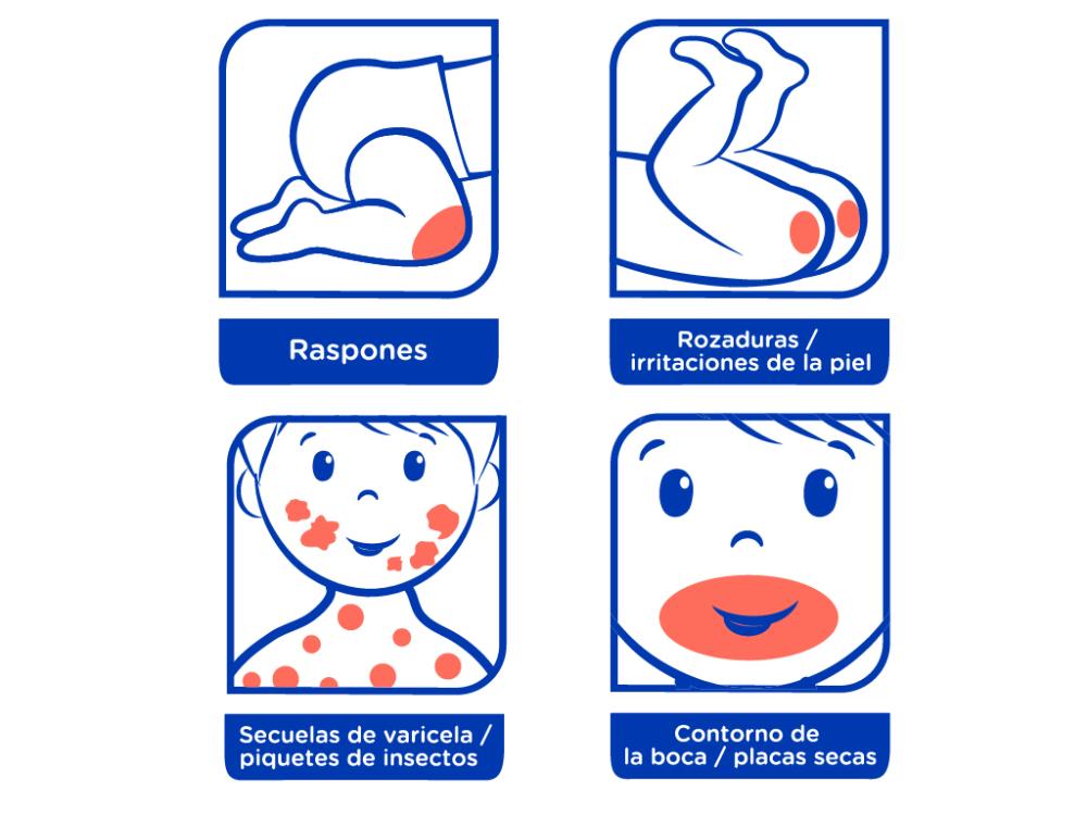Usos Cicastela